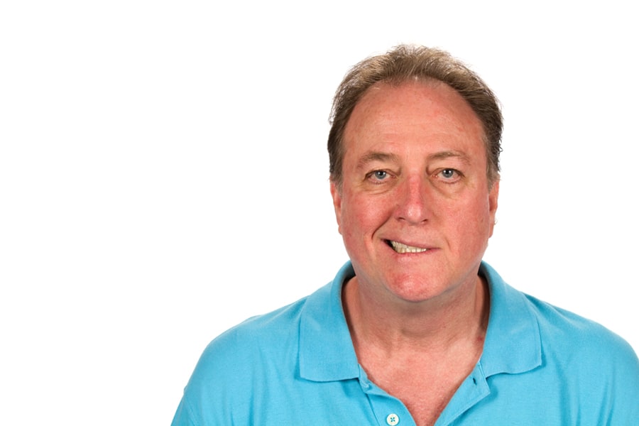 Bells Palsy & Facial Palsy