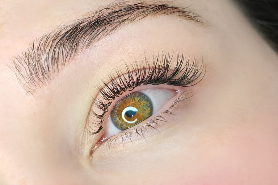 Abnormal Eyelashes