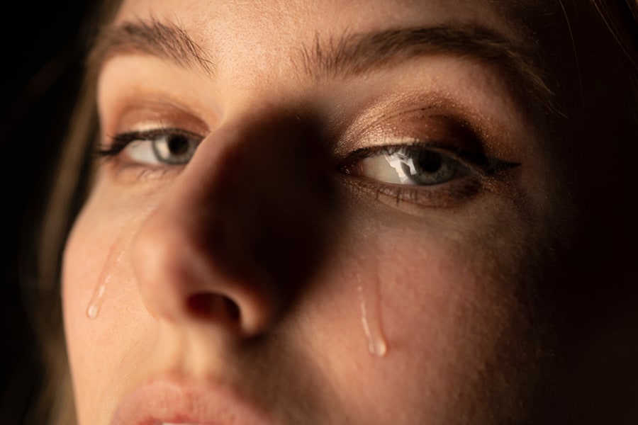 Tearing & Lacrimal Procedures